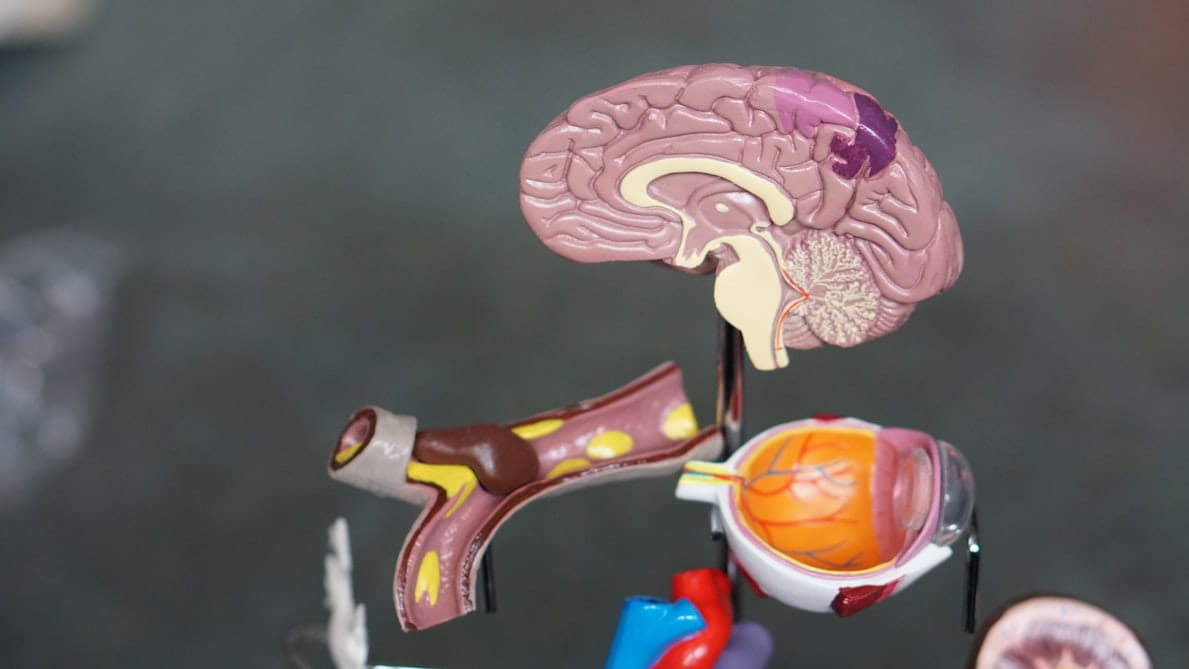 Can CBD Help Multiple Sclerosis Patients?